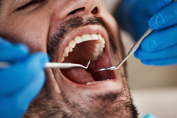 Best Cracked Tooth Emergency Dentist  in Alanuk, AK