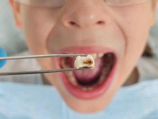 Tooth Infection Emergency Dentist in AK